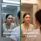 Mascarilla de Té Verde Teapur | Controla la Grasa Desde la Primera Semana
