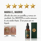 Micofin - Elimina el Hongo de la Uña en 7 Días 100% Natural