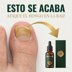 Micofin - Elimina el Hongo de la Uña en 7 Días 100% Natural