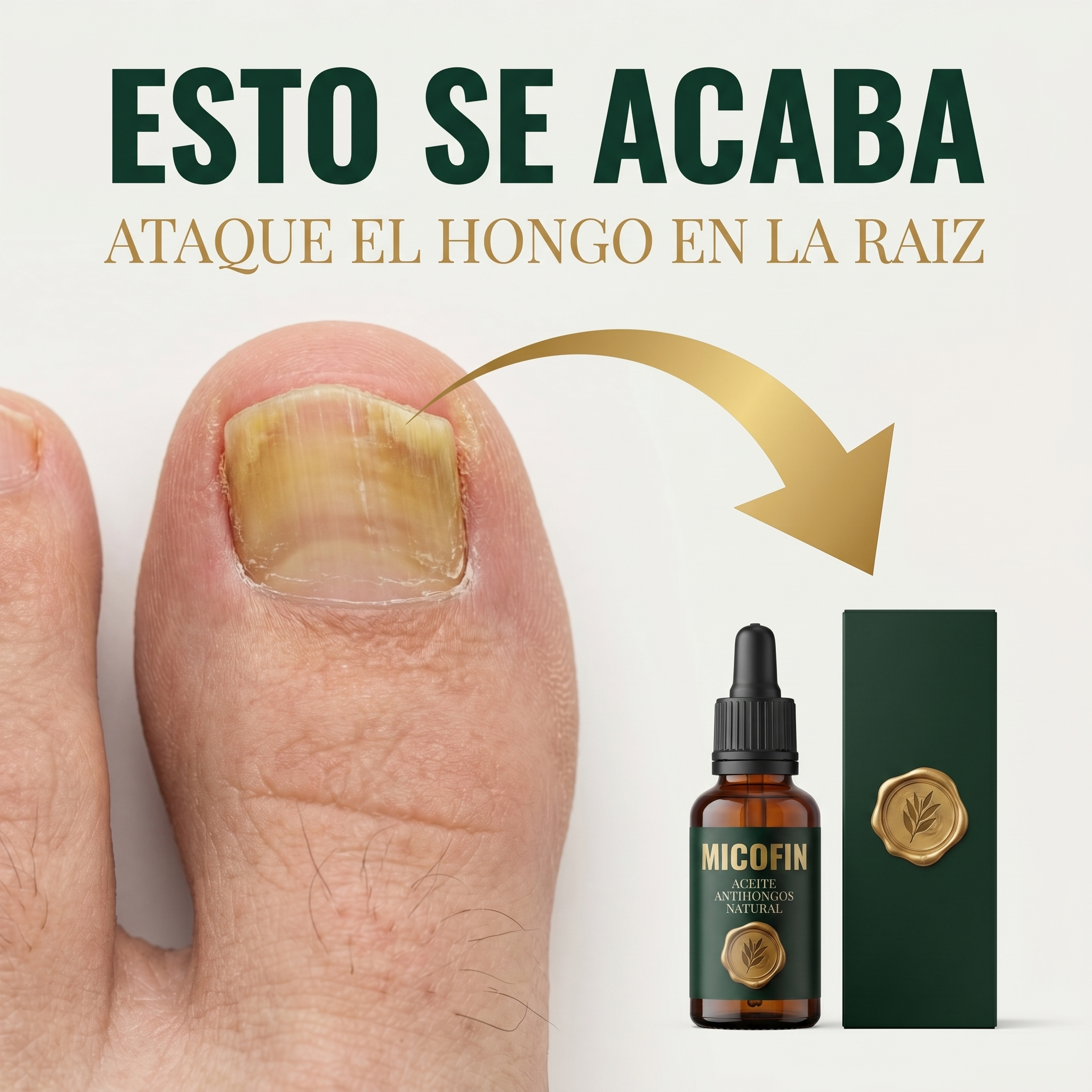 Micofin - Elimina el Hongo de la Uña en 7 Días 100% Natural