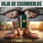 Micofin - Elimina el Hongo de la Uña en 7 Días 100% Natural