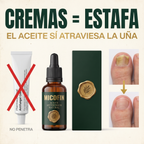 Micofin - Elimina el Hongo de la Uña en 7 Días 100% Natural