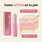 kora-17-como-actua